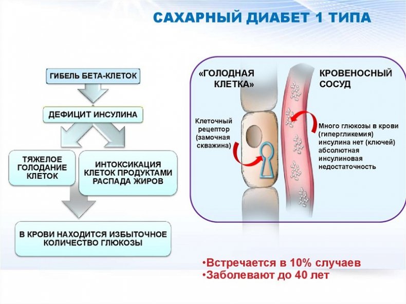 Диабет первого типа