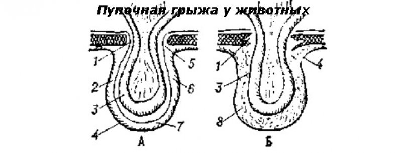 Схема пупочной грыжи