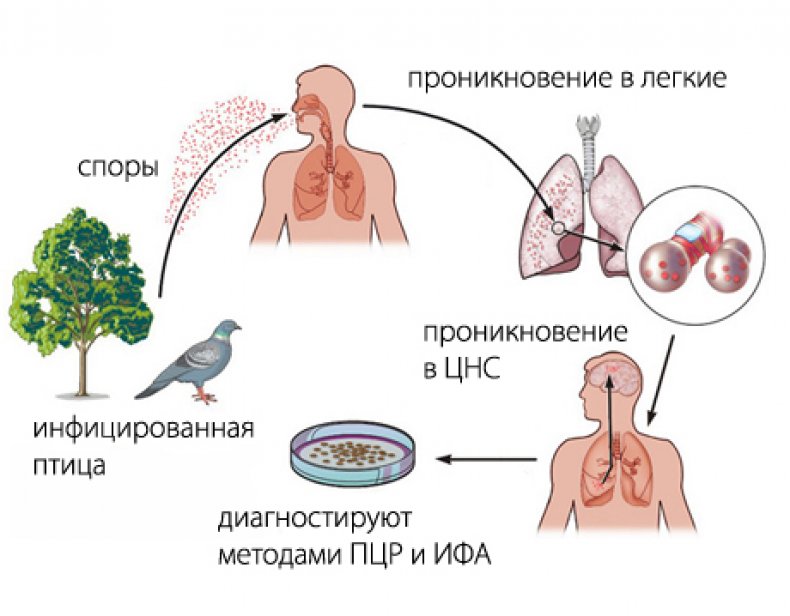 Орнитоз схема