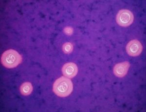 Cryptococcus neoformans